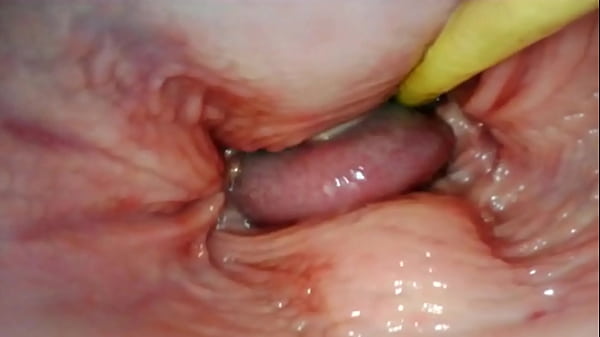 AMAZING INTERNAL POV. CAMERA INSIDE HER PUSSY WHILE I FILL HER WITH CUM